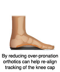 over pronation reduced by orthotics, re-align tracking of knee cap