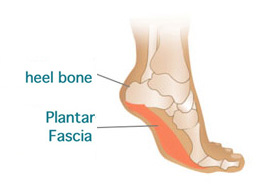 Plantar Fasciitis - Planter Fascitis