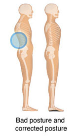 bad posture and correct posture